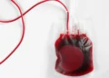 Transfusão, de sangue, Transfusões, Transfusão, de sangue, alheio;